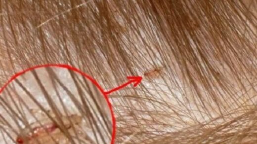 7 Cara Menghilangkan Kutu Kucing dengan Garam Terbaru