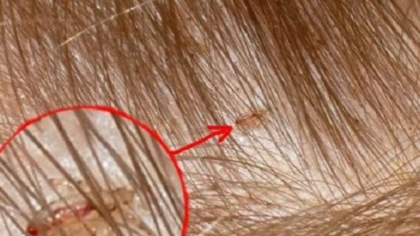 7 Cara Menghilangkan Kutu Kucing dengan Garam Terbaru
